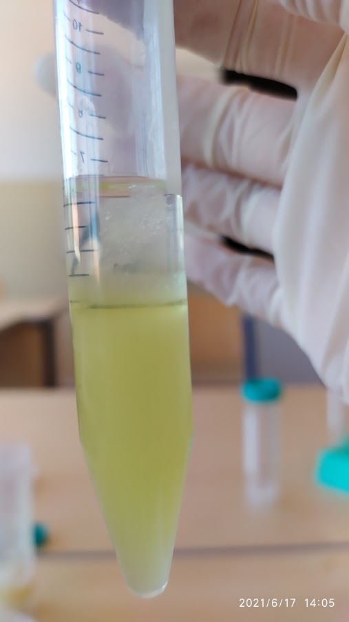 DNA